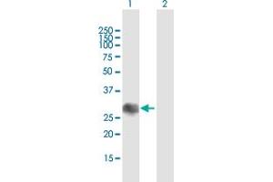 Western Blot analysis of SOCS1 expression in transfected 293T cell line by SOCS1 MaxPab polyclonal antibody. (SOCS1 抗体  (AA 1-211))