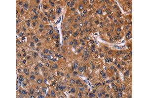 Immunohistochemistry (IHC) image for anti-Nuclear Factor of Activated T-Cells, Cytoplasmic, Calcineurin-Dependent 3 (NFATC3) antibody (ABIN2428467)