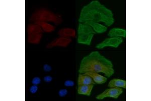 ABIN6258662 and ABIN6275251 staining Hela cells by IF/ICC. (SLC16A2/MCT8 抗体  (Internal Region))