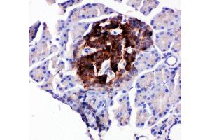 Anti-WISP1 antibody, IHC(P) IHC(P): Rat Pancreas Tissue (WISP1 抗体  (C-Term))