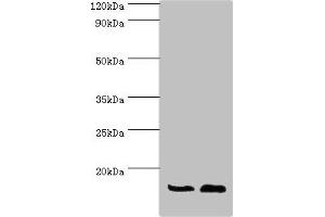 Western blot All lanes: ATP5J antibody at 7 μg/mL Lane 1: Rat brain tissue Lane 2: Mouse heart tissue Secondary Goat polyclonal to rabbit IgG at 1/10000 dilution Predicted band size: 13, 14 kDa Observed band size: 13 kDa (ATP5J 抗体  (AA 1-108))