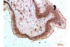 Immunohistochemistry (IHC) image for anti-Tryptase delta 1 (TPSD1) (AA 51-100) antibody (ABIN7189089)