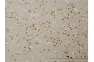 Immunoperoxidase of monoclonal antibody to TBL1X on formalin-fixed paraffin-embedded human cerebral cortex. (TBL1X 抗体  (AA 478-577))