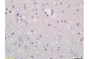 Formalin-fixed and paraffin embedded rat brain labeled with Rabbit Anti-TSHR Polyclonal Antibody (ABIN677378) at 1:200 followed by conjugation to the secondary antibody and DAB staining (TSH receptor 抗体  (AA 201-300))