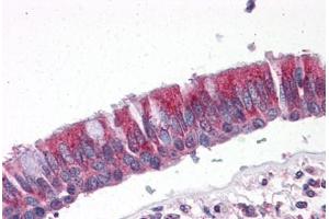 Human Lung, Respiratory Epithelium: Formalin-Fixed, Paraffin-Embedded (FFPE) (CCT2 抗体  (AA 277-473))