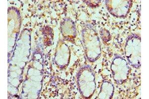 Immunohistochemistry of paraffin-embedded human small intestine tissue using ABIN7146018 at dilution of 1:100 (CCL8 抗体  (AA 23-99))