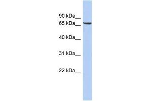 WB Suggested Anti-LRRTM4 Antibody Titration:  0. (LRRTM4 抗体  (Middle Region))