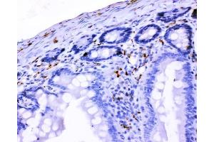 IHC analysis of VIP using anti-VIP antibody (ABIN4886760). (Vip 抗体  (Middle Region))