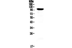 Western blot analysis of RECK using anti-RECK antibody . (RECK 抗体)