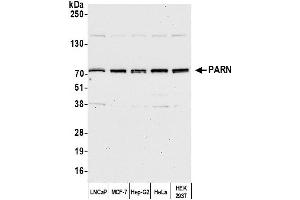Western Blotting (WB) image for anti-Poly A Specific Ribonuclease (PARN) (AA 589-639) antibody (ABIN7454930)