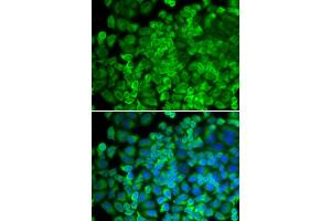 Immunofluorescence analysis of HeLa cells using Galactosidase alpha (Galactosidase alpha (GLA)) antibody (ABIN6131511, ABIN6141114, ABIN6141116 and ABIN6218799). (GLA 抗体  (AA 150-429))