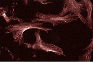 Human Endothelial (UBE2I 抗体  (AA 26-156))