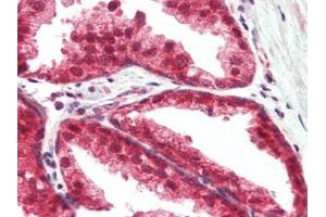 Human Prostate (formalin-fixed, paraffin-embedded) stained with TSLPat 2. (Thymic Stromal Lymphopoietin 抗体)