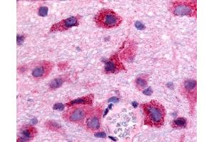 Anti-S1PR5 / EDG8 antibody IHC of rat brain, neurons and glia. (S1PR5 抗体  (N-Term))
