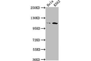 Western Blot Positive WB detected in: Hela whole cell lysate, K562 whole cell lysate All lanes: PIK3CB antibody at 1:1500 Secondary Goat polyclonal to rabbit IgG at 1/50000 dilution Predicted band size: 123 kDa Observed band size: 110 kDa (Recombinant PIK3CB 抗体)
