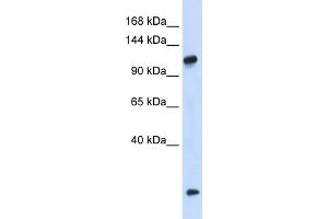 WB Suggested Anti-HEATR4 Antibody Titration: 0. (HEATR4 抗体  (N-Term))