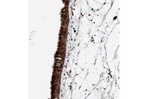 Immunohistochemical staining of human nasopharynx with DNAH8 polyclonal antibody  shows strong cytoplasmic positivity in respiratory epithelial cells at 1:500-1:1000 dilution.