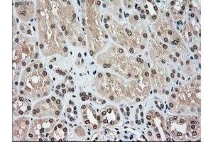 Image no. 2 for anti-Mitogen-Activated Protein Kinase Kinase 4 (MAP2K4) antibody (ABIN1499480) (MAP2K4 抗体)