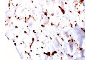 Formalin-fixed, paraffin-embedded human Skeletal Muscle stained with FABP5 Mouse Monoclonal Antibody (CPTC-FABP5-3). (FABP5 抗体)