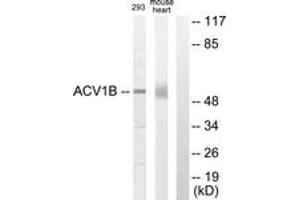 Western blot analysis of extracts from 293/mouse liver cells, using ACV1B Antibody. (Activin A Receptor Type IB/ALK-4 抗体  (AA 73-122))