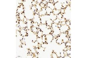 Immunohistochemistry of paraffin embedded mouse lung using rap1 (ABIN7075857) at dilution of 1: 2000 (400x lens) (RAP1 抗体)