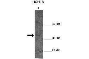 WB Suggested Anti-UCHL5 Antibody  Positive Control: Lane 1:341 µg Zebrafish skin lysate Primary Antibody Dilution: 1:0000Secondary Antibody: Anti-rabbit-HRP Secondry  Antibody Dilution: 1:0000Submitted by: William Tse (UCHL5 抗体  (Middle Region))