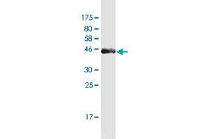 Western Blot detection against Immunogen (37. (PAGE4 抗体  (AA 1-102))
