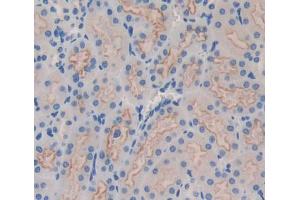 Used in DAB staining on fromalin fixed paraffin- embedded kidney tissue (IRS4 抗体  (AA 1-299))