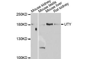 Western blot analysis of extracts of various cell lines, using UTY antibody. (UTY 抗体)