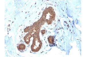 Formalin-fixed, paraffin-embedded human Breast Carcinoma stained with GSTMu2 Mouse Monoclonal Antibody (CPTC-GSTMu2-2). (GSTM4 抗体)