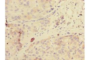 Immunohistochemistry (IHC) image for anti-glycerophosphodiester phosphodiesterase Domain Containing 2 (GDPD2) (AA 210-490) antibody (ABIN7154172)