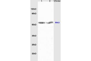 Lane 1: rat liver lysates Lane 2: rat brain lysates probed with Anti Cyp2-j3 Polyclonal Antibody, Unconjugated (ABIN872965) at 1:200 in 4 °C. (Cytochrome P450, Family 2, Subfamily J, Polypeptide 3 (CYP2J3) (AA 401-502) 抗体)