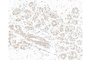 Immunohistochemistry (IHC) image for anti-BRCA1 Associated Protein-1 (Ubiquitin Carboxy-terminal Hydrolase) (BAP1) (AA 475-525) antibody (ABIN7795817)