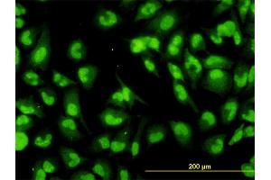 Immunofluorescence of monoclonal antibody to DHX9 on HeLa cell. (DHX9 抗体  (AA 1-90))