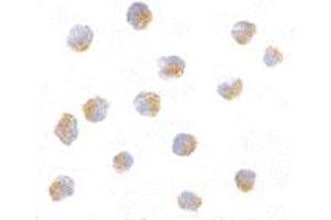 Immunocytochemistry of ATF6 in A-20 with ATF6 polyclonal antibody  at 10 ug/mL . (ATF6 抗体  (N-Term))