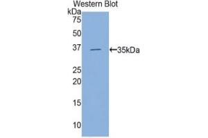 WB of Protein Standard: different control antibodies against Highly purified E. (Hexokinase 2 ELISA 试剂盒)