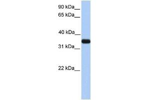 ApoE antibody used at 1 ug/ml to detect target protein. (APOE 抗体  (N-Term))