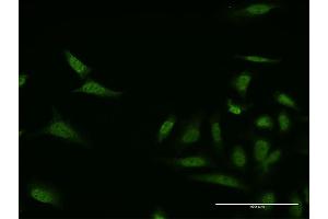 Immunofluorescence of monoclonal antibody to MKNK1 on HeLa cell. (MKNK1 抗体  (AA 1-100))