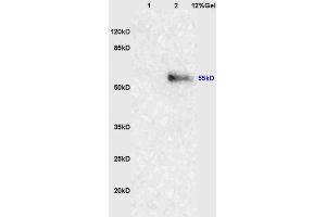 Lane 1: mouse lung lysates Lane 2: human colon carcinoma lysates probed with Anti-NRF-1 Polyclonal Antibody, Unconjugated (ABIN675219) at 1:200 in 4 °C. (NRF1 抗体  (AA 51-180))