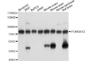 Western blot analysis of extracts of various cell lines, using POMGNT2 antibody (ABIN6289951) at 1:3000 dilution. (C3orf39 抗体)
