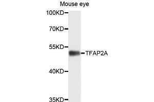 Western blot analysis of extracts of mouse eye cells，using TFAP2A antibody.