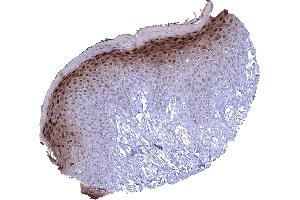 Skin In the skin a nuclear and cytoplasmic Cystatin A immunostaining is predominantly seen in the granular cell layer. (CSTA 抗体)