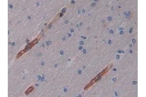 Detection of CYTH2 in Human Cerebrum Tissue using Polyclonal Antibody to Cytohesin 2 (CYTH2) (Cytohesin 2 抗体  (AA 1-390))