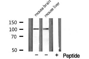 Western blot analysis on HuvEc cell lysate using NARG1 Antibody (NAA15 抗体  (Internal Region))