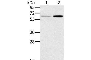 Western Blot analysis of Human liver and Mouse kidney tissue using TNFRSF11A Polyclonal Antibody at dilution of 1:200 (TNFRSF11A 抗体)