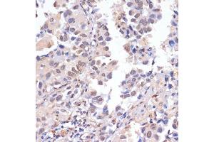 Immunohistochemistry (IHC) image for anti-P53-Induced Death Domain Protein (PIDD) (AA 1-85) antibody (ABIN1680710)