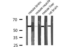 Western Blotting (WB) image for anti-Dihydrouridine Synthase 2-Like (DUS2L) (C-Term) antibody (ABIN6261379)