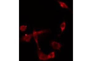 ABIN6275430 staining  HepG2 cells by IF/ICC. (PDK2 抗体  (Internal Region))