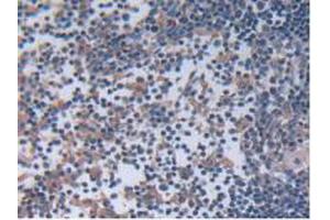 IHC-P analysis of Rat Lymph Node Tissue, with DAB staining. (IL12A 抗体  (AA 23-215))