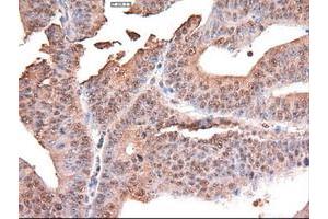 Image no. 10 for anti-Myc Proto-Oncogene protein (MYC) antibody (ABIN1497012) (c-MYC 抗体)